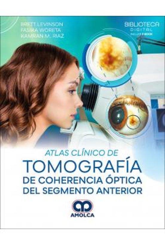 Atlas Clínico De Tomografía De Coherencia Óptica Del Segmento Anterior