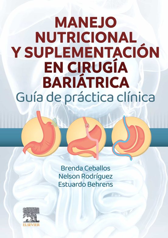 Manejo Nutricional Y Suplementación En Cirugía Bariátrica. Guía De Prá