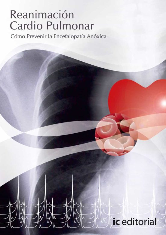 Reanimacion Cardiopulmonar