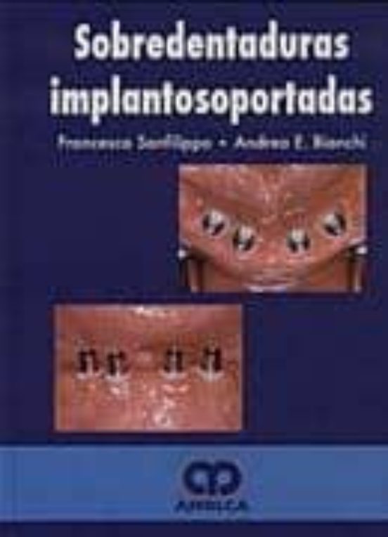 Sobredentaduras Implatosoportadas