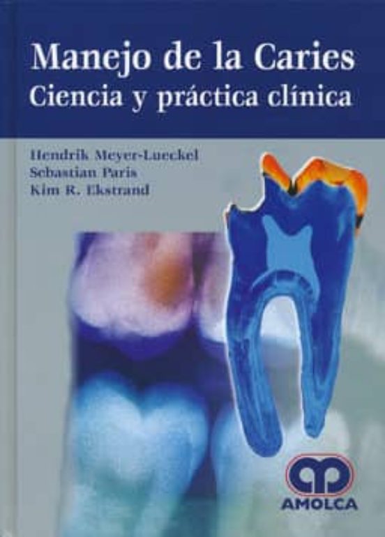 Manejo De La Caries: Ciencia Y Practica Clinica