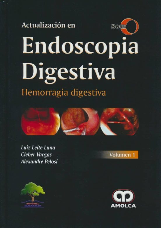 Hemorragia Digestiva