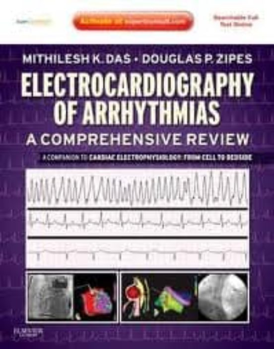 Electrocardiograhy Of Arrhythmias: A Comprehensive Review A Comp Anion