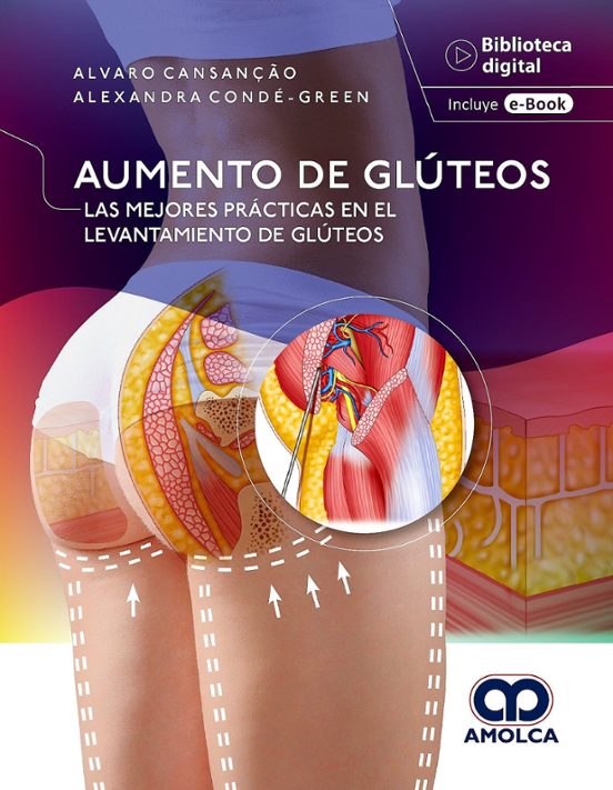 Aumento De Glúteos. Las Mejores Prácticas En El Levantamiento De Glúte