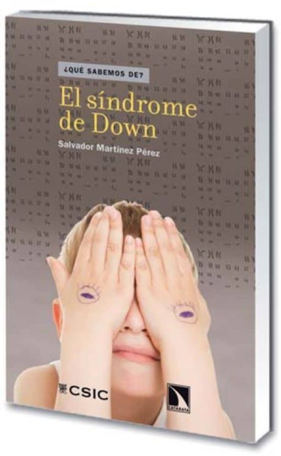 El Síndrome De Down