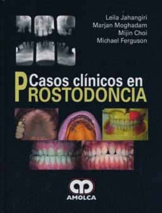 Casos Clinicos En Prostodoncia