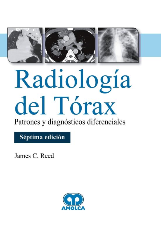 Radiología Del Tórax. Patrones Y Diagnósticos Diferenciales
