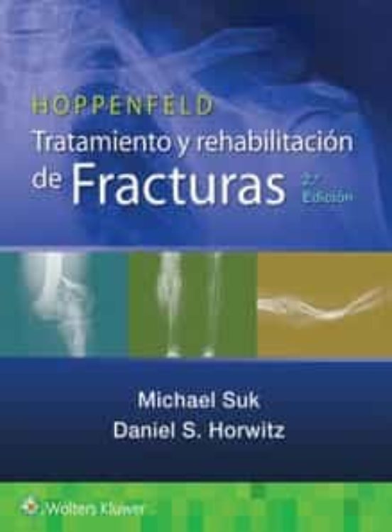 Hoppenfeld. Tratamiento Y Rehabilitación De Fracturas