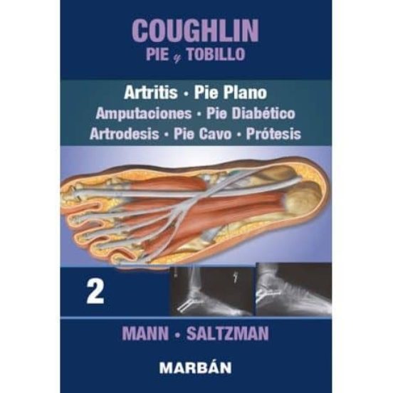 Coughlin: Pie Y Tobillo: Tomo Ii Artritis Pie Plano: Amputaciones Pie