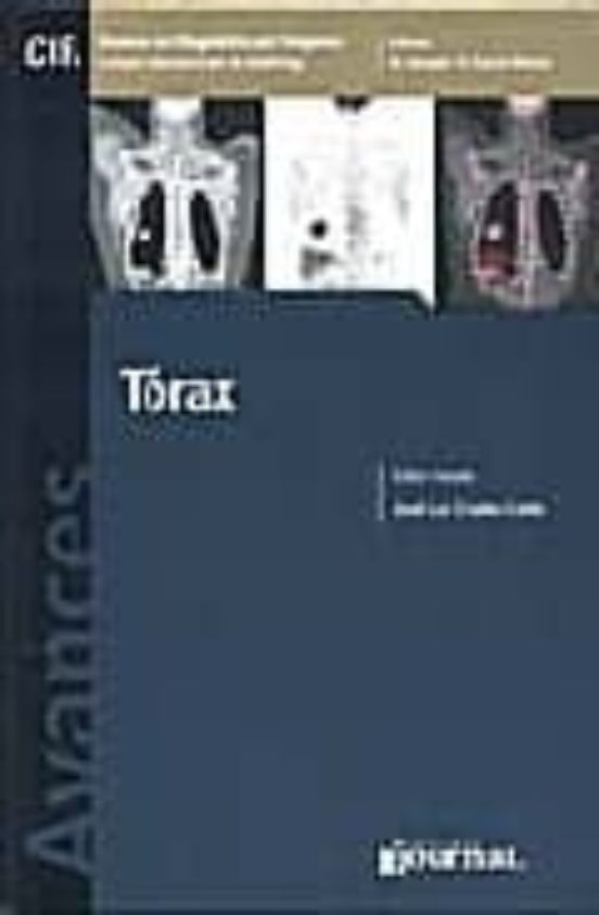 Avances En Diagnostico Por Imagenes : Torax