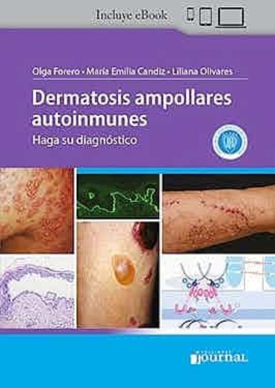 Dermatosis Ampollares Autoinmunes