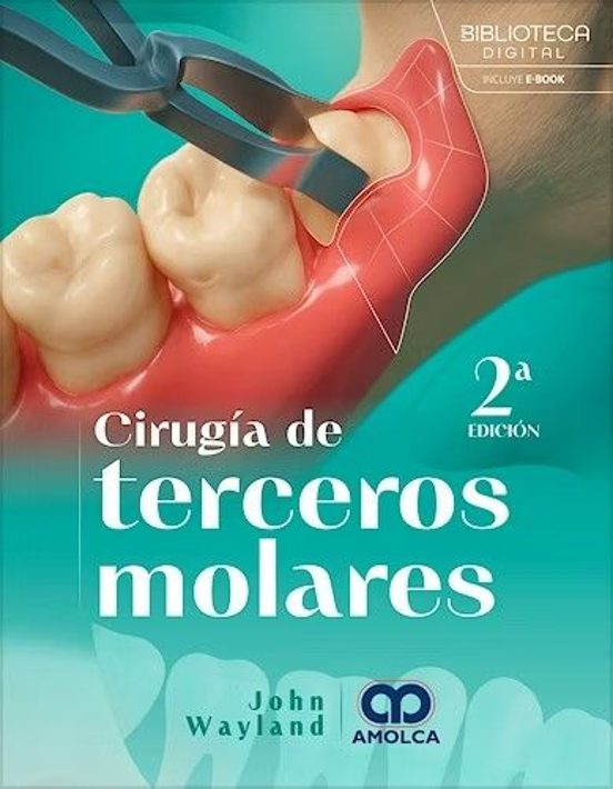 Cirugía De Terceros Molares
