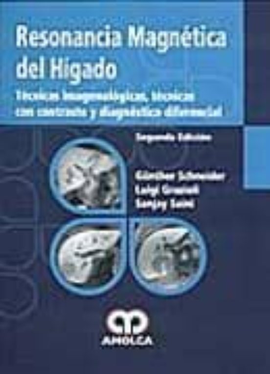 Resonancia Magnetica Del Higado