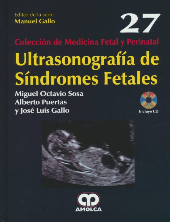Ultrasonografia De Sindromes Fetales