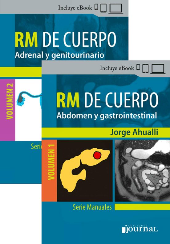 Manual De Rm De Cuerpo : Vol. 1 Abdomen Y Gastrointe Stin