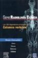 SERIE POCKET DE RADIOLOGIA: LOS 100 DIAGNOSTICOS PRINCIPALES EN C OLUMNA VERTEBRAL di BRANT-ZAWADZKI, M.  CHEN, M.Z. 
