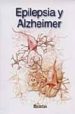 (MINIATLAS) EPILEPSIA Y ALZHEIMER di VV.AA. 