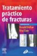TRATAMIENTO PRACTICO DE LAS FRACTUAS (4 ED.) de MCRAE, RONALD  ESSER, MAX 