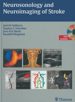NEUROSONOLOGY AND NEUROIMAGING OF STROKE (INCLUYE DVD) di VALDUEZA, J. 