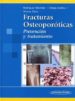 FRACTURAS OSTEOPOROTICAS: PREVENCION Y TRATAMIENTO de ALONSO CARRO, G.  ORTEGA ANDREU, M.  RODRIGUEZ MERCHAN, E.C. 