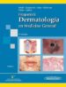 FITZPATRICK: DERMATOLOGIA EN MEDICINA GENERAL (T. 2)(7 ED.) di WOLFF, KLAUS 