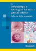 COLPOSCOPIA Y PATOLOGIA DEL TRACTO GENITAL INFERIOR EN LA ERA DE LA VACUNACION di TATTI 