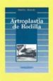 ARTROPLASTIA DE RODILLA de ORDOEZ, J.M. 