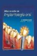 ATLAS EN COLOR DE IMPLANTOLOGIA ORAL de CRANIN, A. NORMAN  KLEIN, MICHAEL  SIMONS, ALAN 